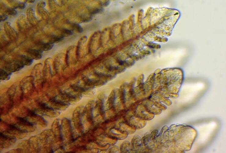 Terrifying Creatures You Can Only See Under A Microscope