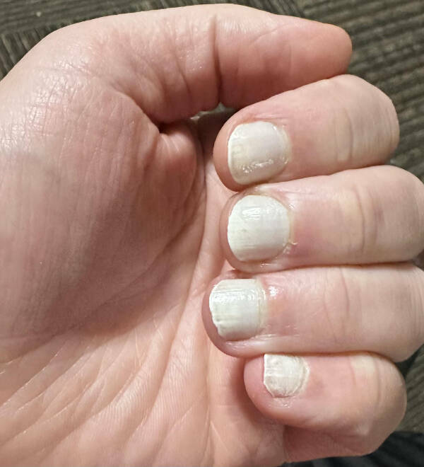 Someone Is Having A Bad Day