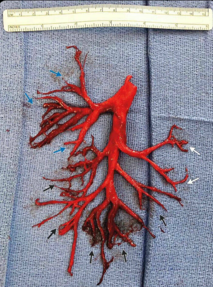 Eerie Pics That Send A Chill Down Your Spine