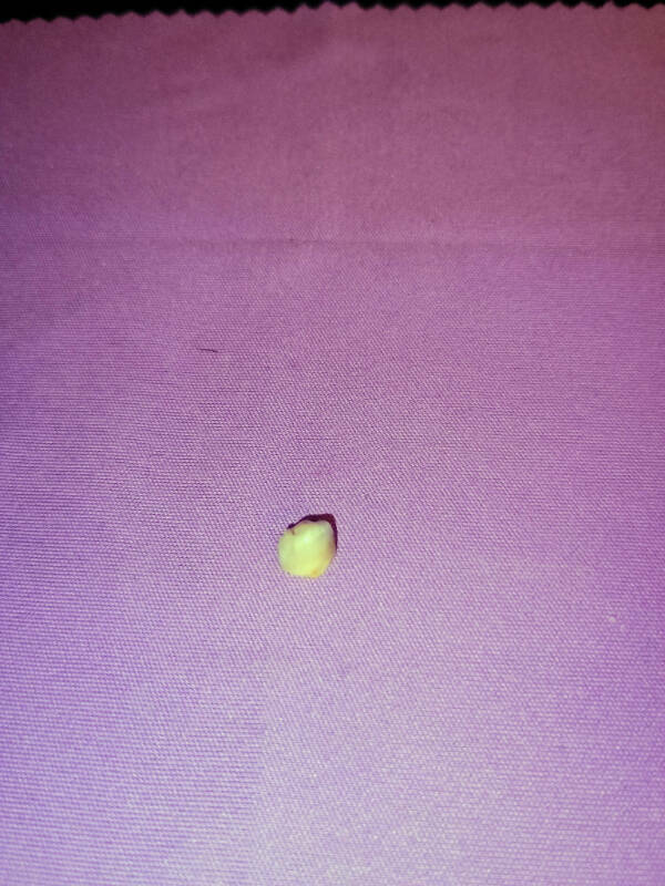 When Bad Days Strike