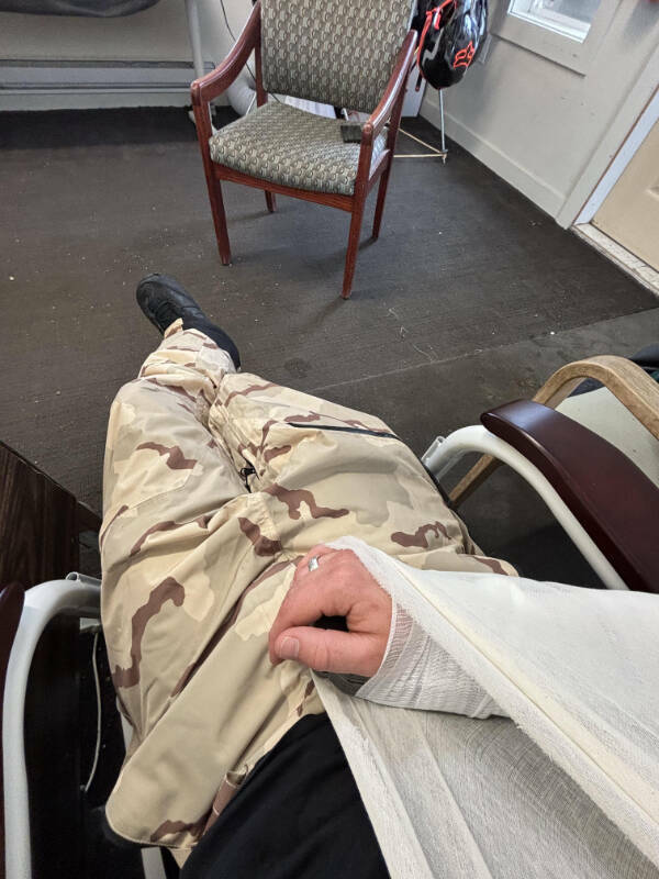 When Bad Days Strike