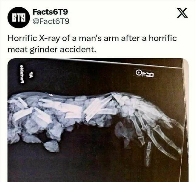 Unbelievable Facts That Sound Fake But Aren’t