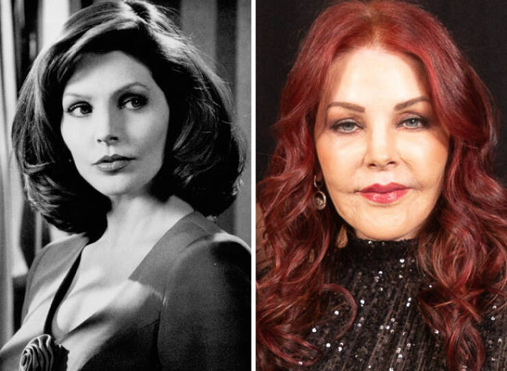 Famous Faces Before And After: The Impact of Cosmetic Surgery