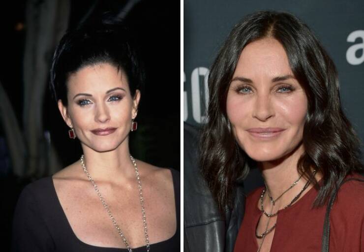 Famous Faces Before And After: The Impact of Cosmetic Surgery