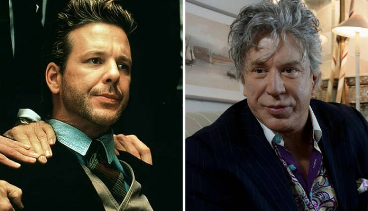 Famous Faces Before And After: The Impact of Cosmetic Surgery