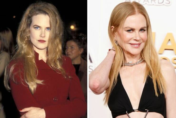 Famous Faces Before And After: The Impact of Cosmetic Surgery