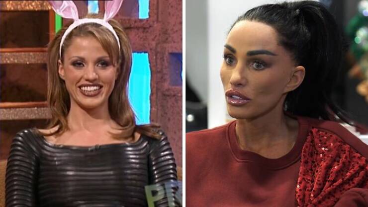 Famous Faces Before And After: The Impact of Cosmetic Surgery