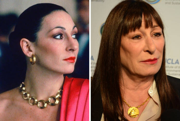 Famous Faces Before And After: The Impact of Cosmetic Surgery