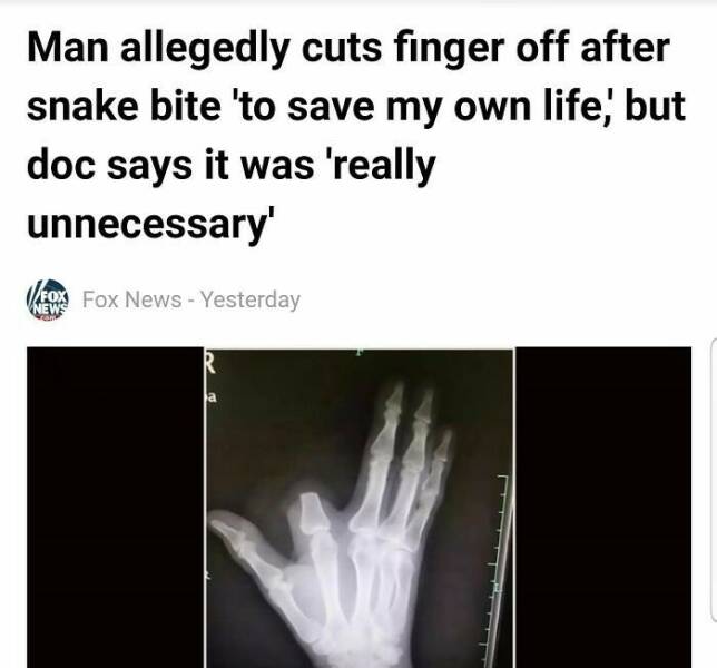 When Safety Takes A Backseat