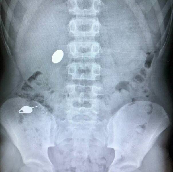 Proof That Parenting Is Just Controlled Chaos