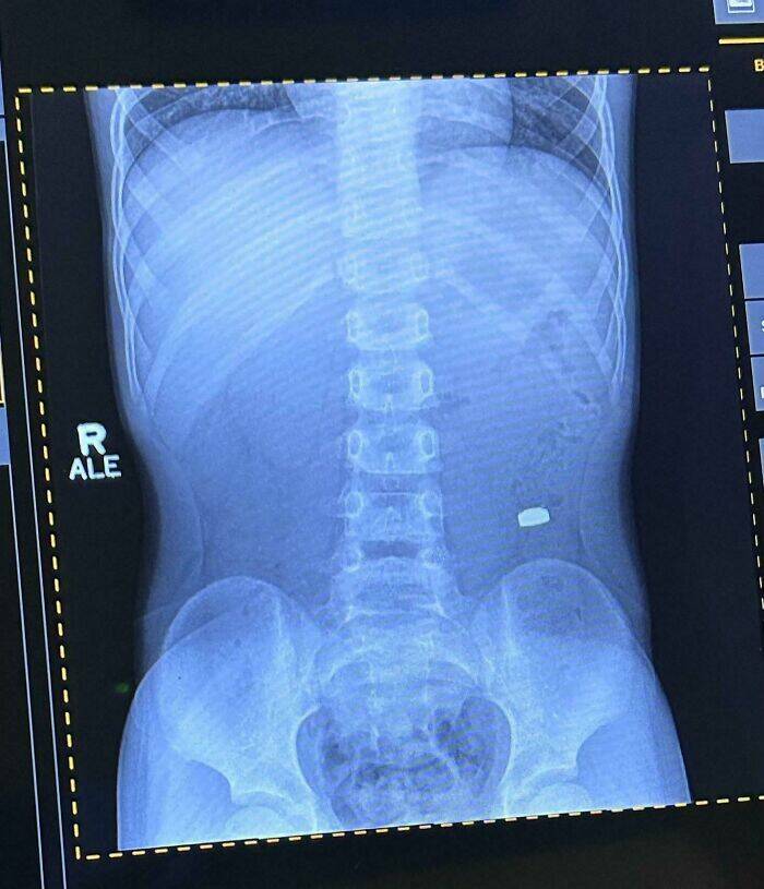 Proof That Parenting Is Just Controlled Chaos