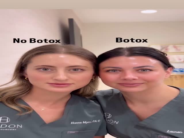 What Botox Does To Your Facial Expressions