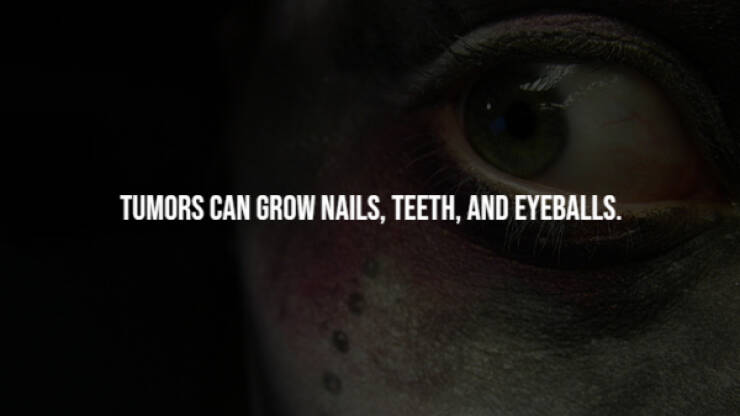 Unsettling Facts You Wish You Didn’t Know