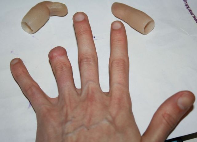 Extraordinary prosthesis (13 pics)