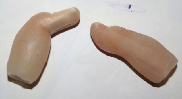 Extraordinary prosthesis (13 pics)