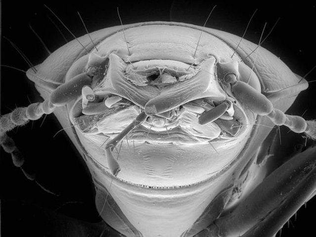 The horror under the microscope (12 photos)