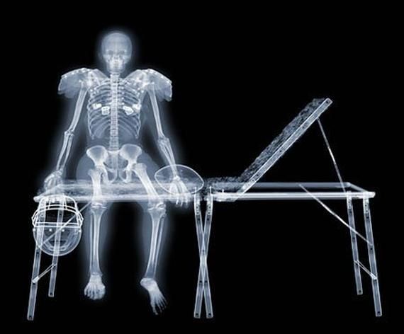 Life through X-ray beams (59 picture)
