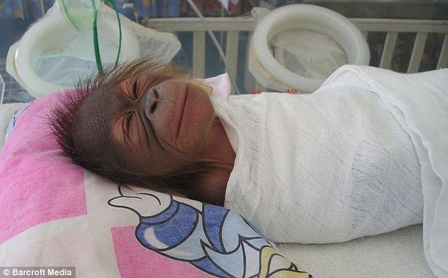 Welcome to the world's only orang-utan hospital (11 фото)