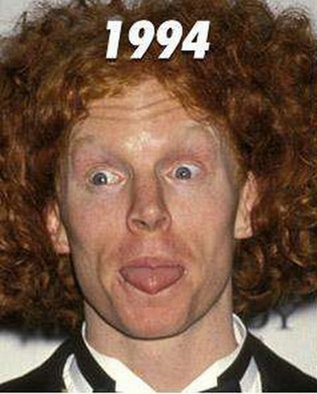 Carrot Top, another victim of plastic surgery (31 pics)