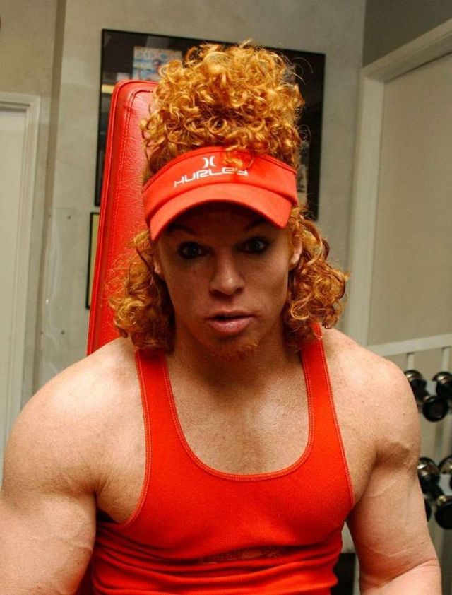 Carrot Top, another victim of plastic surgery (31 pics)