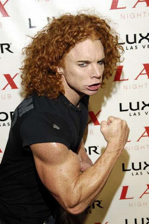 Carrot Top, another victim of plastic surgery (31 pics)