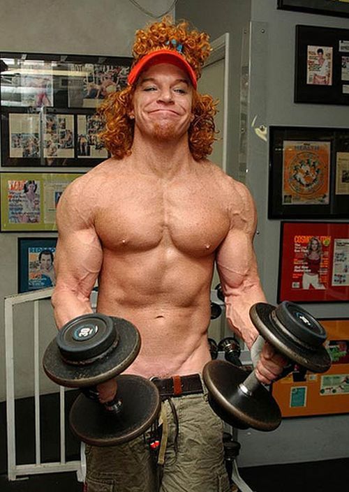 Carrot Top, another victim of plastic surgery (31 pics)