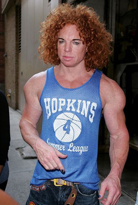 Carrot Top Another Victim Of Plastic Surgery 31 Pics 