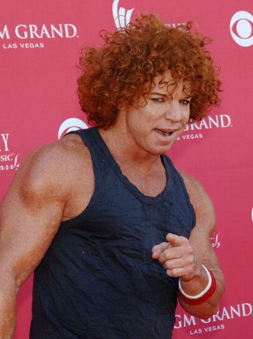 Carrot Top, another victim of plastic surgery (31 pics)