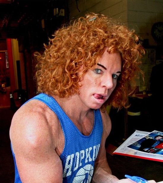 Carrot Top, another victim of plastic surgery (31 pics ...