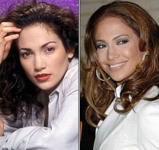 The most wonderful celebrity transformations (16 pics)