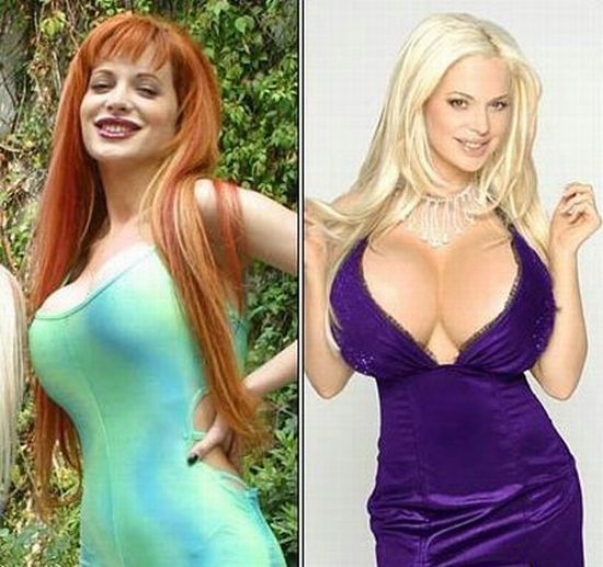 The most wonderful celebrity transformations (16 pics)