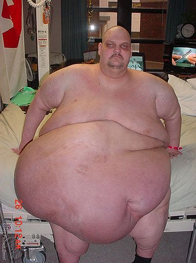 One of the heaviest men in the world has been taken to the hospital (19 pics)