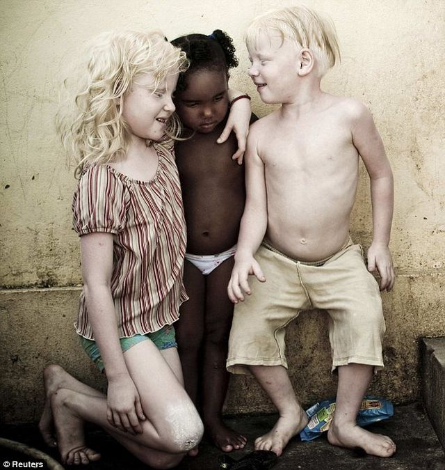 A black Brazilian mother has given birth to 3 albino children! (4 pics)