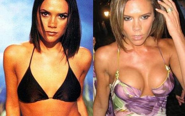 Victoria Beckham: before and after (23 pics)