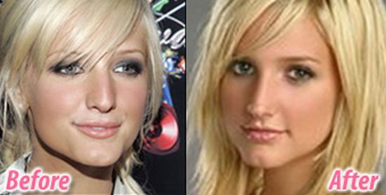 Stars before and after plastic surgery (47 pics)