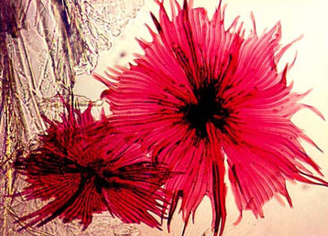 Amazing microscope photography that will make you say wow! (50 pics)