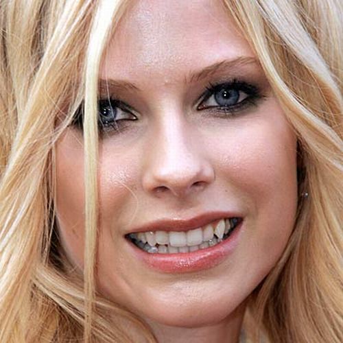 Celebrities with Bad Teeth (13 pics)