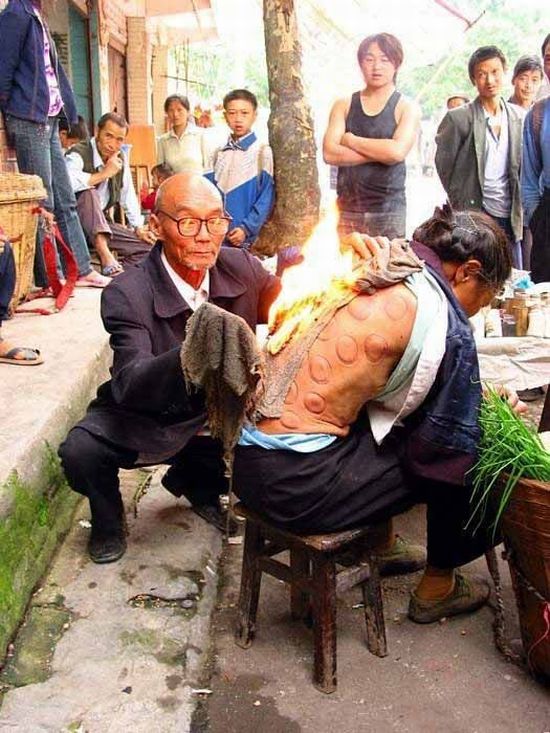 Chinese Traditional Medicine (7 pics)