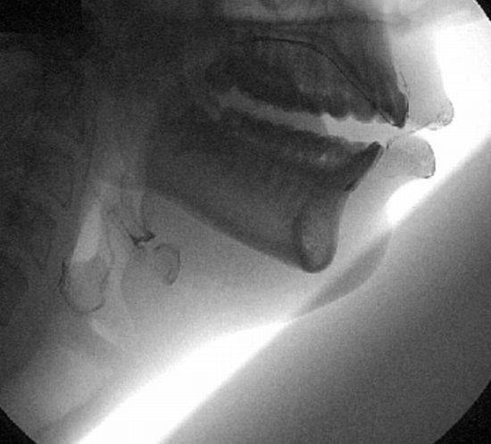 Interesting X-Ray Analyses of Speech (2 gifs)