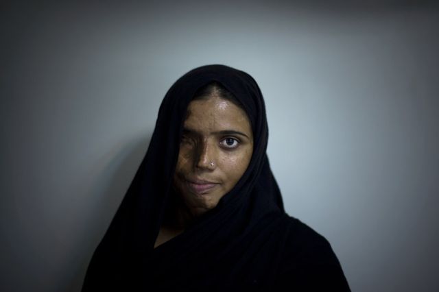OMG of the Day. “Acid Terrorism” Against Women in Pakistan (12 pics + text)