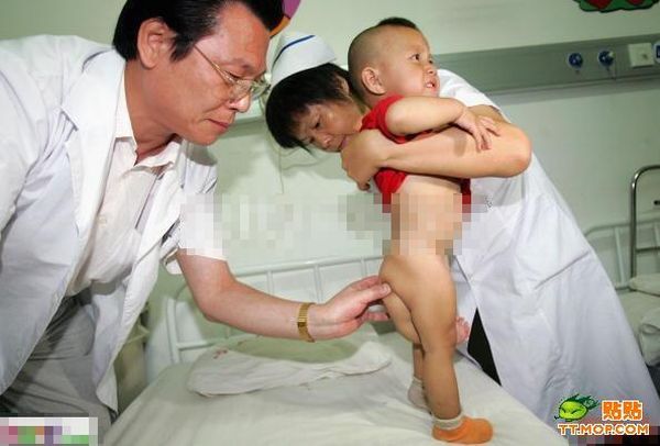 Poor Children with Abnormalities (13 pics)