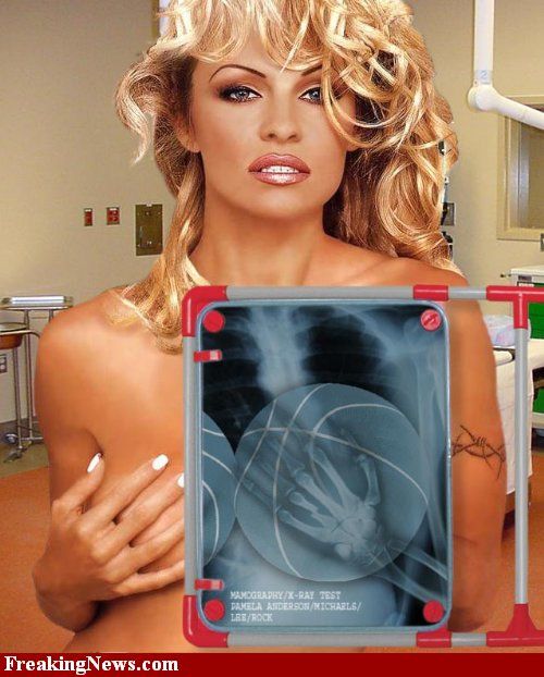 Celebrities Under X-Rays (29 pics)