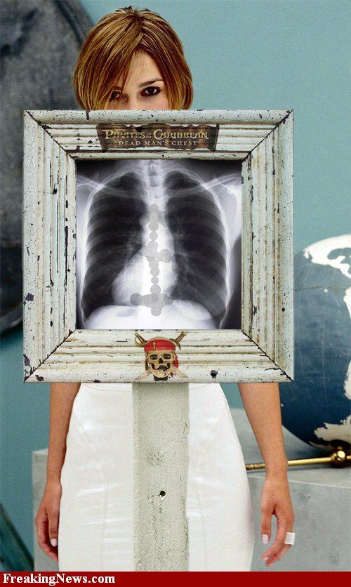 Celebrities Under X-Rays (29 pics)