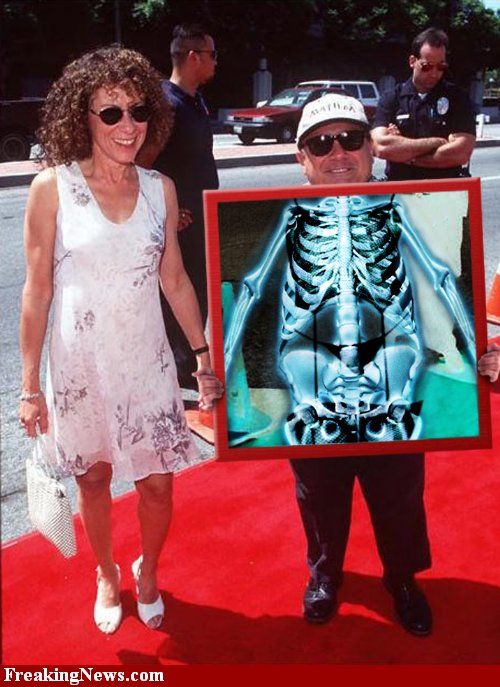 Celebrities Under X-Rays (29 pics)