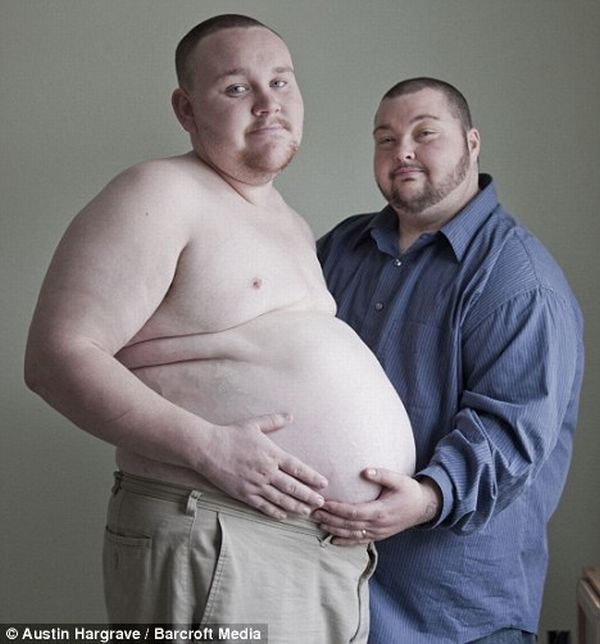 Another Pregnant Man (5 pics)