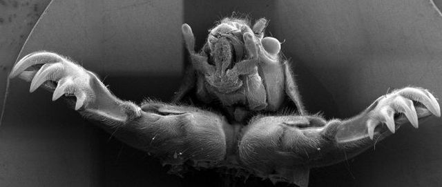Up Close And Personal With Crab Louse (5 pics)