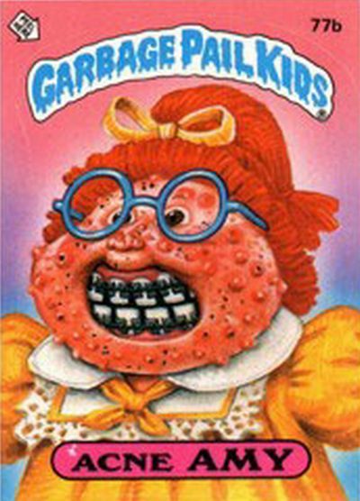 It’s Those Ugly Garbage Pail Kids Again (25 pics)