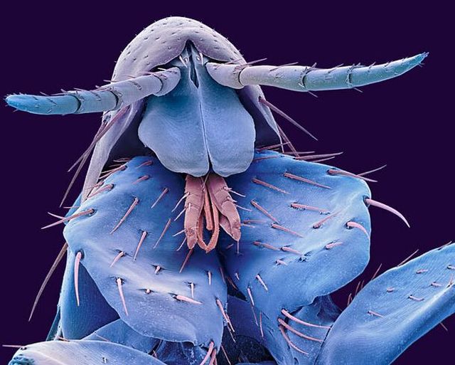 The Wonders of the Electron Microscope (12 pics)