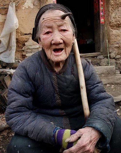Grandma with a Horn on Her Forhead! (6 pics)