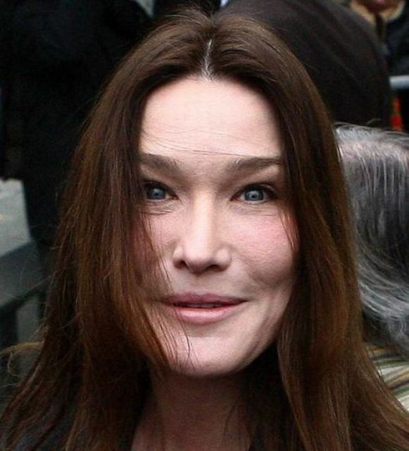 What Is Wrong With Carla Bruni’s Face? (7 pics)